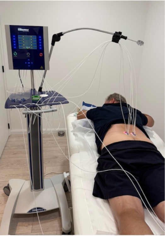 Laser acupunctuur behandeling